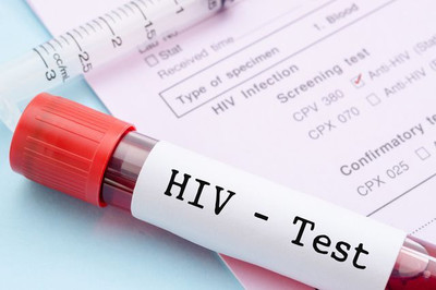 Во время экспресс-тестирование на ВИЧ выявлено 4 положительных результата